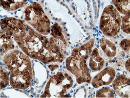 KHK / Ketohexokinase Antibody - IHC of paraffin-embedded Human Kidney tissue using anti-KHK mouse monoclonal antibody.