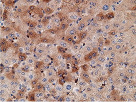 KHK / Ketohexokinase Antibody - IHC of paraffin-embedded Human liver tissue using anti-KHK mouse monoclonal antibody.