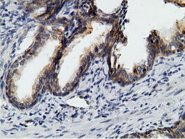 KHK / Ketohexokinase Antibody - IHC of paraffin-embedded Human prostate tissue using anti-KHK mouse monoclonal antibody.