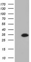 KHK / Ketohexokinase Antibody - HEK293T cells were transfected with the pCMV6-ENTRY control (Left lane) or pCMV6-ENTRY KHK (Right lane) cDNA for 48 hrs and lysed. Equivalent amounts of cell lysates (5 ug per lane) were separated by SDS-PAGE and immunoblotted with anti-KHK.