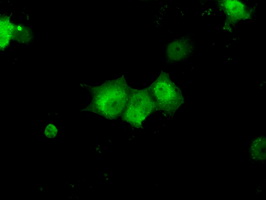 KHK / Ketohexokinase Antibody - Anti-KHK mouse monoclonal antibody  immunofluorescent staining of COS7 cells transiently transfected by pCMV6-ENTRY KHK.