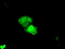 KHK / Ketohexokinase Antibody - Anti-KHK mouse monoclonal antibody  immunofluorescent staining of COS7 cells transiently transfected by pCMV6-ENTRY KHK.