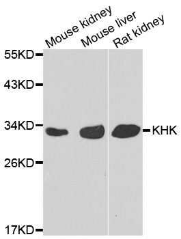 KHK / Ketohexokinase Antibody - Western blot analysis of extracts of various cell lines.