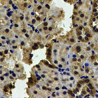 KHK / Ketohexokinase Antibody - Immunohistochemical analysis of Ketohexokinase staining in human kidney formalin fixed paraffin embedded tissue section. The section was pre-treated using heat mediated antigen retrieval with sodium citrate buffer (pH 6.0). The section was then incubated with the antibody at room temperature and detected using an HRP conjugated compact polymer system. DAB was used as the chromogen. The section was then counterstained with hematoxylin and mounted with DPX.