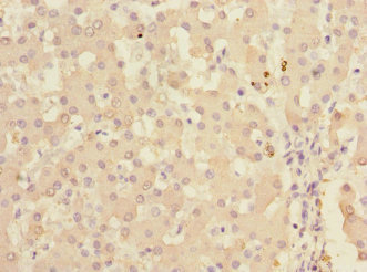 KHK / Ketohexokinase Antibody - Immunohistochemistry of paraffin-embedded human liver tissue at dilution 1:100