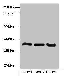 KHK / Ketohexokinase Antibody - Western blot All Lanes: KHKantibody at 3.6ug/ml Lane 1 : Mouse liver tissue Lane 2 : Mouse kidney tissue Lane 3 : Rat kidney tissue Secondary Goat polyclonal to Rabbit IgG at 1/10000 dilution Predicted band size: 33 kDa Observed band size: 33 kDa