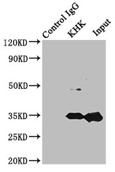 KHK / Ketohexokinase Antibody - Immunoprecipitating KHK in Mouse liver tissue Lane 1: Rabbit control IgG instead of KHK Antibody in Mouse liver tissue.For western blotting, a HRP-conjugated Protein G antibody was used as the secondary antibody (1/2000) Lane 2: KHK Antibody (8µg) + Mouse liver tissue (500µg) Lane 3: Mouse liver tissue (10µg)