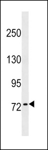 KHNYN Antibody - KHNYN Antibody western blot of NCI-H292 cell line lysates (35 ug/lane). The KHNYN antibody detected the KHNYN protein (arrow).