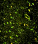 KHSRP / FBP2 Antibody - Immunofluorescence of KHSRP Antibody with paraffin-embedded human brain tissue. 0.05 mg/ml primary antibody was followed by FITC-conjugated goat anti-rabbit lgG (whole molecule). FITC emits green fluorescence.