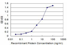 KHSRP / FBP2 Antibody - Detection limit for recombinant GST tagged KHSRP is approximately 0.3 ng/ml as a capture antibody.