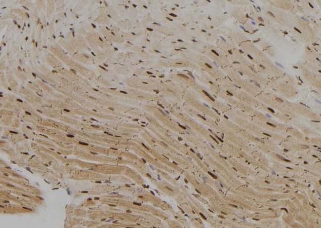KHSRP / FBP2 Antibody - 1:100 staining rat heart tissue by IHC-P. The sample was formaldehyde fixed and a heat mediated antigen retrieval step in citrate buffer was performed. The sample was then blocked and incubated with the antibody for 1.5 hours at 22°C. An HRP conjugated goat anti-rabbit antibody was used as the secondary.