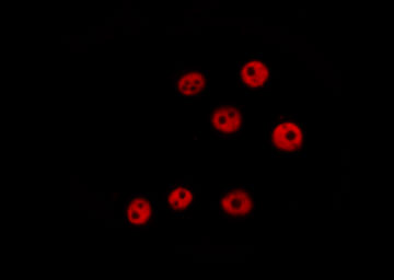 KHSRP / FBP2 Antibody - Staining HeLa cells by IF/ICC. The samples were fixed with PFA and permeabilized in 0.1% Triton X-100, then blocked in 10% serum for 45 min at 25°C. The primary antibody was diluted at 1:200 and incubated with the sample for 1 hour at 37°C. An Alexa Fluor 594 conjugated goat anti-rabbit IgG (H+L) antibody, diluted at 1/600, was used as secondary antibody.