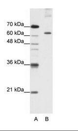 KIAA0020 / PEN Antibody - A: Marker, B: HepG2 Cell Lysate.  This image was taken for the unconjugated form of this product. Other forms have not been tested.