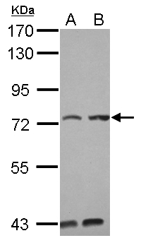 KIAA0020 / PEN Antibody - Sample (30 ug of whole cell lysate) A: Jurkat B: Raji 7.5% SDS PAGE KIAA0020 antibody diluted at 1:1000
