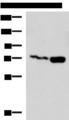 KIAA0020 / PEN Antibody - Western blot analysis of Jurkat and Raji cell lysates  using PUM3 Polyclonal Antibody at dilution of 1:800