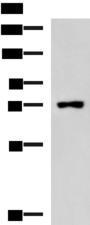 KIAA0020 / PEN Antibody - Western blot analysis of Raji cell lysate  using PUM3 Polyclonal Antibody at dilution of 1:800