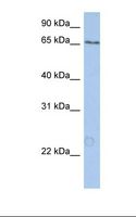KIAA0020 / PEN Antibody - NTERA2 cell lysate. Antibody concentration: 1.0 ug/ml. Gel concentration: 12%.  This image was taken for the unconjugated form of this product. Other forms have not been tested.