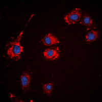 KIAA0100 / BCOX Antibody - Immunofluorescent analysis of BCOX1 staining in A431 cells. Formalin-fixed cells were permeabilized with 0.1% Triton X-100 in TBS for 5-10 minutes and blocked with 3% BSA-PBS for 30 minutes at room temperature. Cells were probed with the primary antibody in 3% BSA-PBS and incubated overnight at 4 deg C in a humidified chamber. Cells were washed with PBST and incubated with a DyLight 594-conjugated secondary antibody (red) in PBS at room temperature in the dark. DAPI was used to stain the cell nuclei (blue).