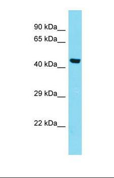 KIAA0141 Antibody - Western blot of Human HepG2. KIAA0141 antibody dilution 1.0 ug/ml.  This image was taken for the unconjugated form of this product. Other forms have not been tested.
