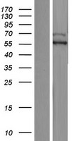 KIAA0141 Protein - Western validation with an anti-DDK antibody * L: Control HEK293 lysate R: Over-expression lysate