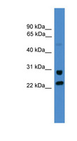 KIAA0152 / MLEC Antibody - MLEC antibody Western blot of 721_B cell lysate. This image was taken for the unconjugated form of this product. Other forms have not been tested.