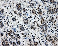 KIAA0153 / TTLL12 Antibody - Immunohistochemical staining of paraffin-embedded breast tissue using anti-TTLL12 mouse monoclonal antibody. (Dilution 1:50).