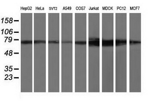 KIAA0153 / TTLL12 Antibody - Western blot of extracts (35 ug) from 9 different cell lines by using anti-TTLL12 monoclonal antibody.