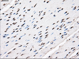 KIAA0153 / TTLL12 Antibody - Immunohistochemical staining of paraffin-embedded colon tissue using anti-TTLL12 mouse monoclonal antibody. (Dilution 1:50).