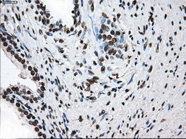 KIAA0153 / TTLL12 Antibody - Immunohistochemical staining of paraffin-embedded prostate tissue using anti-TTLL12 mouse monoclonal antibody. (Dilution 1:50).