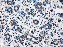 KIAA0153 / TTLL12 Antibody - Immunohistochemical staining of paraffin-embedded breast tissue using anti-TTLL12 mouse monoclonal antibody. (Dilution 1:50).