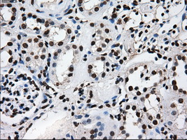 KIAA0153 / TTLL12 Antibody - Immunohistochemical staining of paraffin-embedded Kidney tissue using anti-TTLL12 mouse monoclonal antibody. (Dilution 1:50).