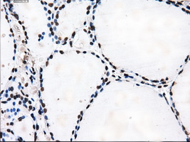 KIAA0153 / TTLL12 Antibody - Immunohistochemical staining of paraffin-embedded thyroid tissue using anti-TTLL12 mouse monoclonal antibody. (Dilution 1:50).