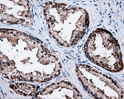 KIAA0153 / TTLL12 Antibody - IHC of paraffin-embedded prostate tissue using anti-TTLL12 mouse monoclonal antibody. (Dilution 1:50).