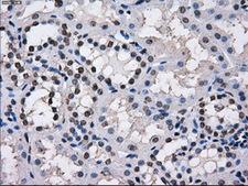 KIAA0153 / TTLL12 Antibody - Immunohistochemical staining of paraffin-embedded Kidney tissue using anti-TTLL12 mouse monoclonal antibody. (Dilution 1:50).