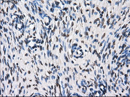 KIAA0153 / TTLL12 Antibody - Immunohistochemical staining of paraffin-embedded Ovary tissue using anti-TTLL12 mouse monoclonal antibody. (Dilution 1:50).