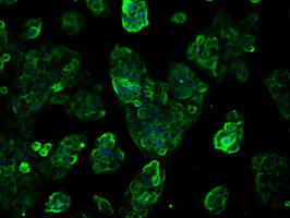 KIAA0153 / TTLL12 Antibody - Immunofluorescent staining of HepG2 cells using anti-TTLL12 mouse monoclonal antibody.