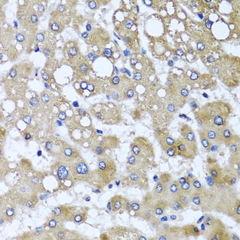 KIAA0153 / TTLL12 Antibody - Immunohistochemistry of paraffin-embedded human liver injury tissue.