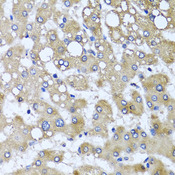 KIAA0153 / TTLL12 Antibody - Immunohistochemistry of paraffin-embedded human liver injury tissue.