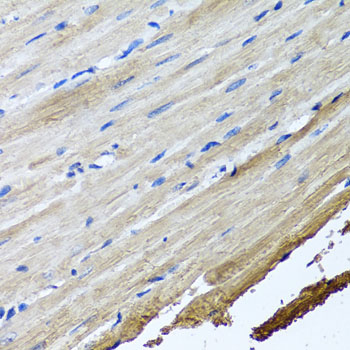 KIAA0153 / TTLL12 Antibody - Immunohistochemistry of paraffin-embedded rat heart.
