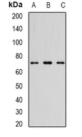 KIAA0153 / TTLL12 Antibody - Western blot analysis of TTLL12 expression in NIH3T3 (A); mouse thymus (B); mouse heart (C) whole cell lysates.