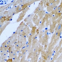 KIAA0153 / TTLL12 Antibody - Immunohistochemical analysis of TTLL12 staining in rat heart formalin fixed paraffin embedded tissue section. The section was pre-treated using heat mediated antigen retrieval with sodium citrate buffer (pH 6.0). The section was then incubated with the antibody at room temperature and detected using an HRP conjugated compact polymer system. DAB was used as the chromogen. The section was then counterstained with hematoxylin and mounted with DPX.