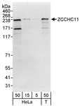 KIAA0191 / ZCCHC11 Antibody - Detection of Human ZCCHC11 by Western Blot. Samples: Whole cell lysate from HeLa (5, 15 and 50 ug) and 293T (T; 50 ug) cells. Antibodies: Affinity purified rabbit anti-ZCCHC11 antibody used for WB at 0.04 ug/ml. Detection: Chemiluminescence with an exposure time of 30 seconds.