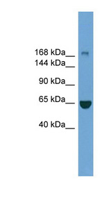 KIAA0191 / ZCCHC11 Antibody - ZCCHC11 antibody Western blot of ACHN lysate. This image was taken for the unconjugated form of this product. Other forms have not been tested.