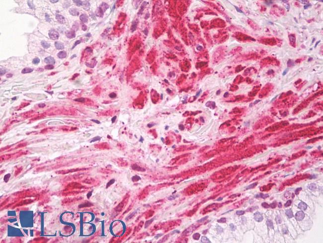 KIAA0191 / ZCCHC11 Antibody - Anti-KIAA0191 / ZCCHC11 antibody IHC of human prostate. Immunohistochemistry of formalin-fixed, paraffin-embedded tissue after heat-induced antigen retrieval. Antibody dilution 5-7.5 ug/ml.  This image was taken for the unconjugated form of this product. Other forms have not been tested.