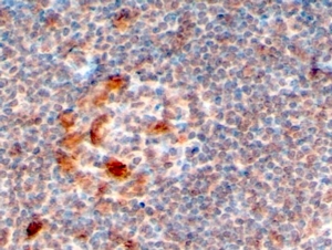 KIAA0191 / ZCCHC11 Antibody - Goat Anti-ZCCHC11 / PAPD3 Antibody (4µg/ml) staining of paraffin embedded Human Lymph Node. Steamed antigen retrieval with citrate buffer pH 6, HRP-staining.