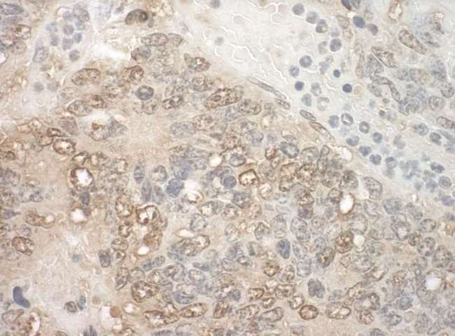 KIAA0191 / ZCCHC11 Antibody - Detection of Mouse ZCCHC11 by Immunohistochemistry. Sample: FFPE section of mouse teratoma. Antibody: Affinity purified rabbit anti-ZCCHC11 used at a dilution of 1:250.