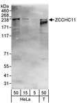 KIAA0191 / ZCCHC11 Antibody - Detection of Human ZCCHC11 by Western Blot. Samples: Whole cell lysate from HeLa (5, 15 and 50 ug) and 293T (T; 50 ug) cells. Antibodies: Affinity purified rabbit anti-ZCCHC11 antibody used for WB at 0.04 ug/ml. Detection: Chemiluminescence with an exposure time of 3 minutes.