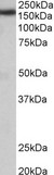 KIAA0191 / ZCCHC11 Antibody - ZCCHC11 antibody (0.05 ug/ml) staining of Rat Brain lysate (35 ug protein in RIPA buffer). Primary incubation was 1 hour. Detected by chemiluminescence.