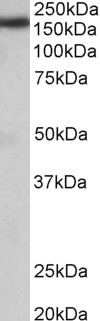 KIAA0191 / ZCCHC11 Antibody - ZCCHC11 antibody (0.05 ug/ml) staining of Rat Brain lysate (35 ug protein in RIPA buffer). Primary incubation was 1 hour. Detected by chemiluminescence.