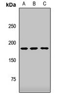 KIAA0191 / ZCCHC11 Antibody
